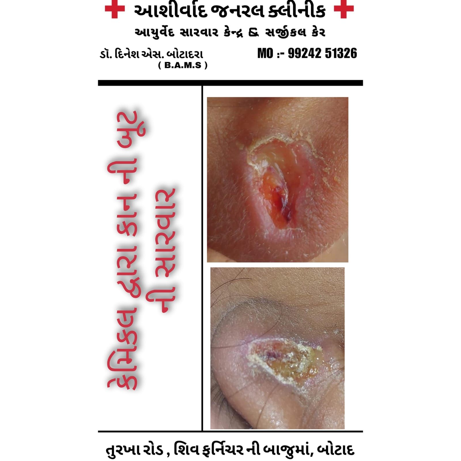 Chronic Skin Disease Therapy