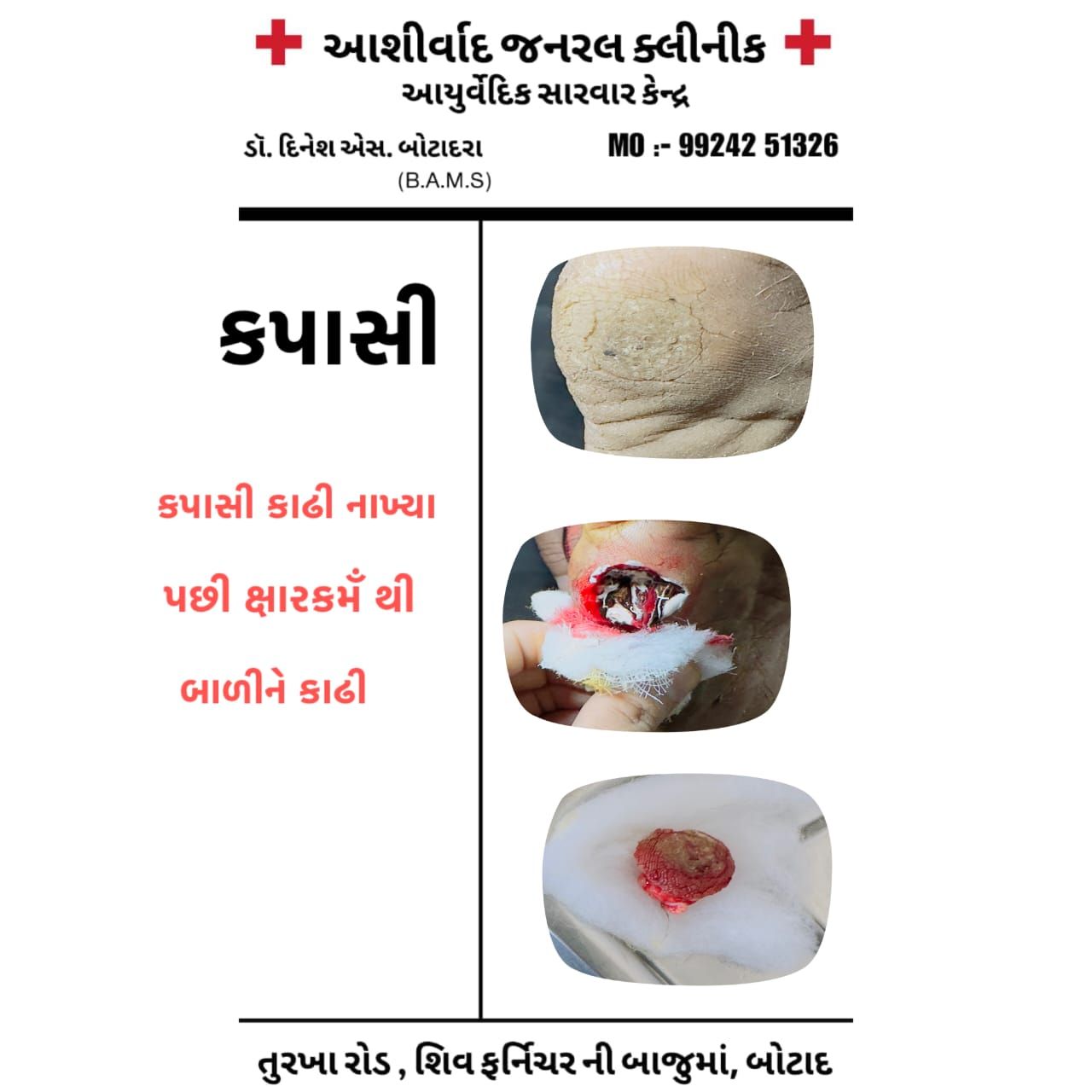 Hypertension Support