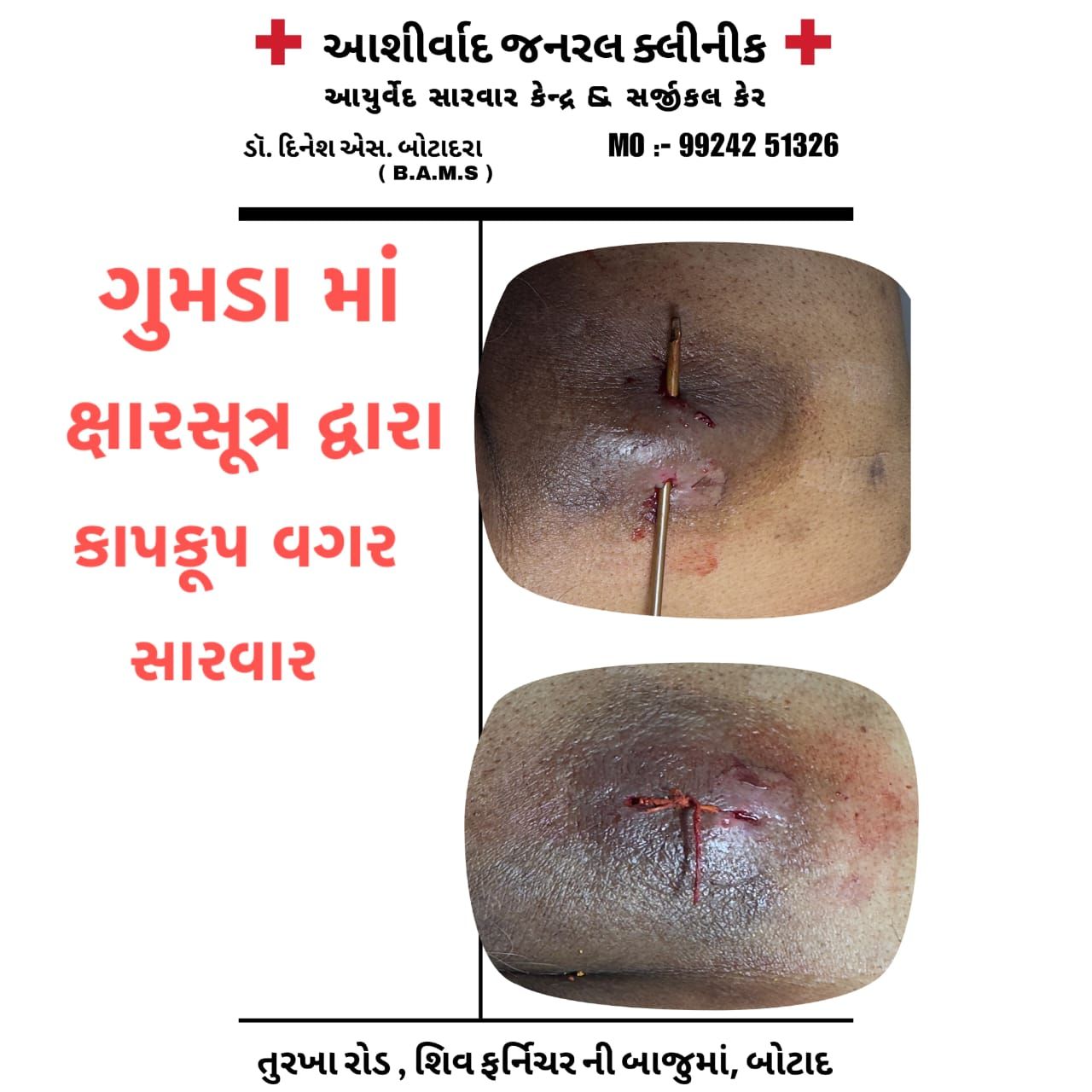 Panchakarma Detoxification
